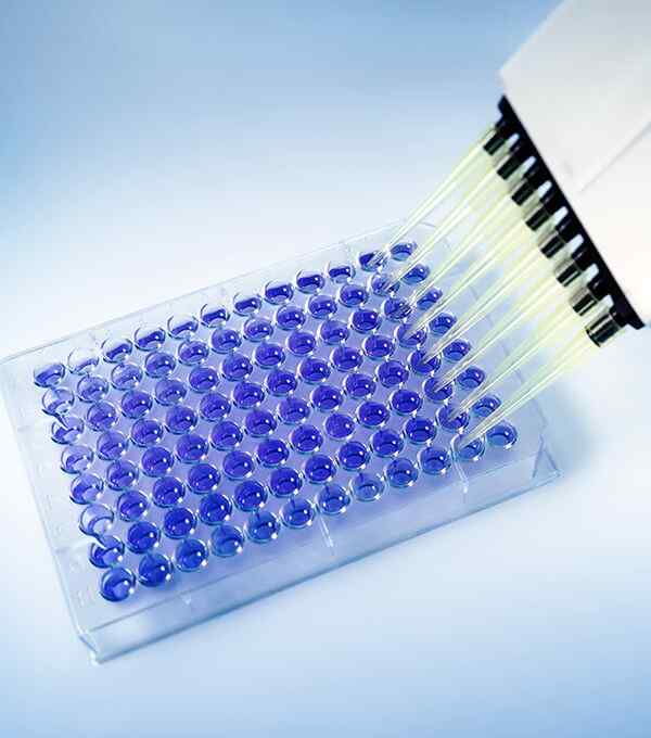 https://www.ozonmedicalcenter.it/wp-content/uploads/2020/04/service_7.jpg